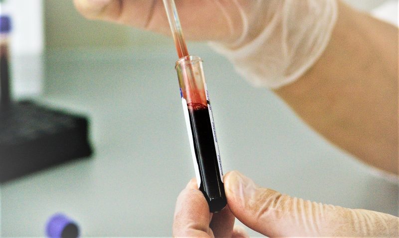 Eritrosedimentación