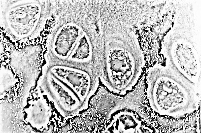 Tejido cartilaginoso