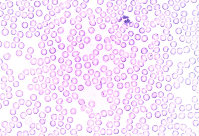 Teoría endosimbiótica